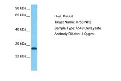 TP53INP2 Rabbit anti-Human, Polyclonal, Novus Biologicals 0.1 mL | Buy Online | Novus Biologicals | Fisher Scientific